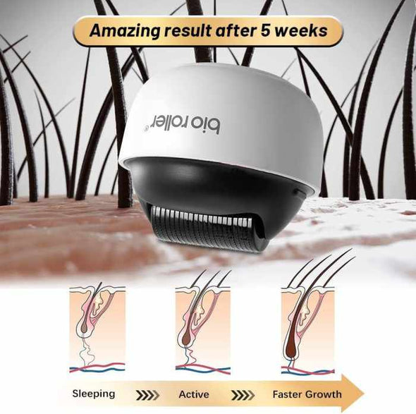 1200 Titanium Pin Microneedle Derma Roller For Hair - Aroflit