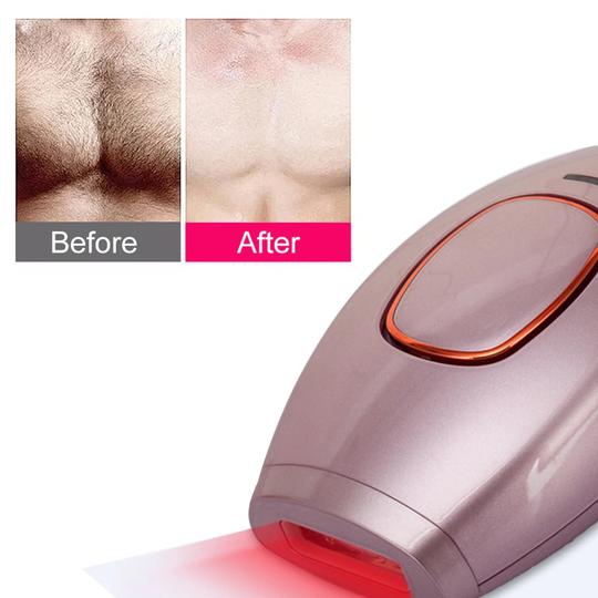 IPL Laser Hair Removal Handset for Painless Permanent Hair Reduction