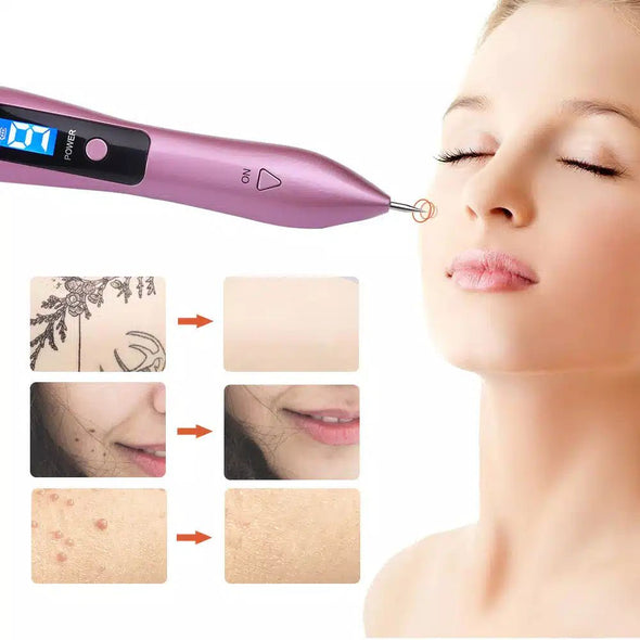 Dermalise™ LCD Laser Plasma Pen for Freckle, Skin Tag, Spot, Mole, Tattoo Removal - Aroflit