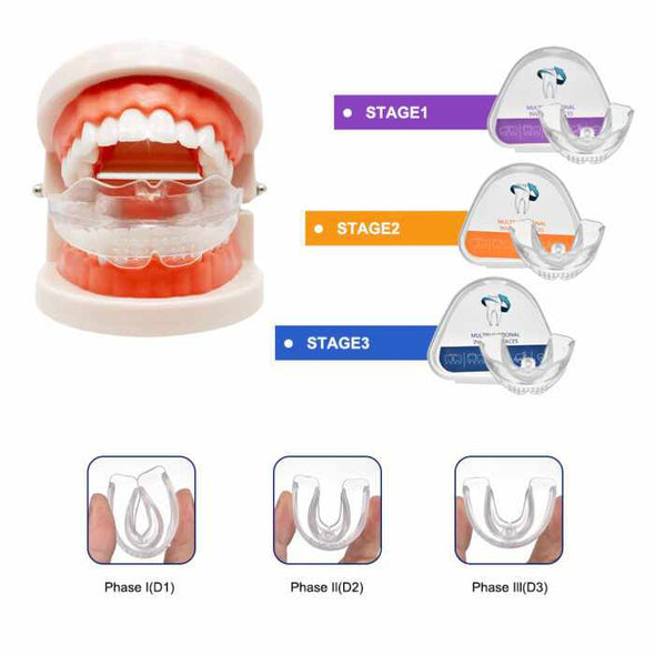 Orthodontic Dental Braces Smile Teeth Alignment Trainer - Aroflit