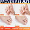 Revolutionary Nail Fungus Laser Device for Fast and Pain - Free - Aroflit