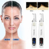 SkinRenu™ Laser Pen Tattoo Removal - Aroflit