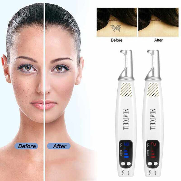 SkinRenu™ Laser Pen Tattoo Removal - Aroflit