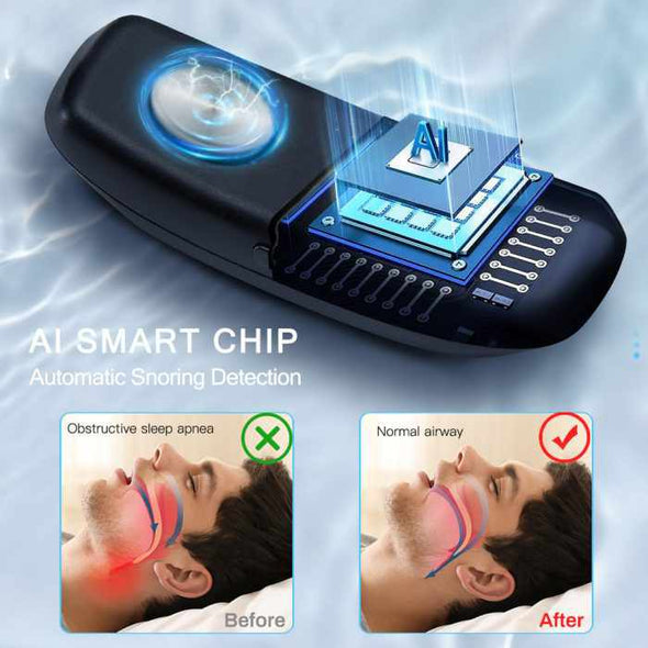 Smart Anti Snoring Device - Aroflit