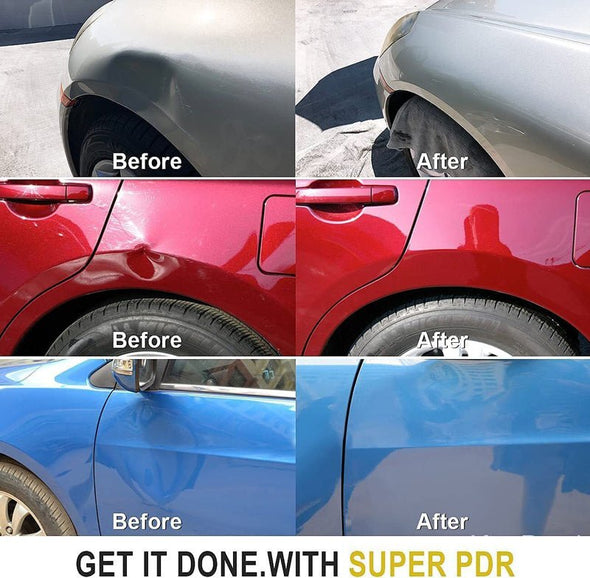 Aroflit Dent Puller™ Paintless Dent Repair Kit - Aroflit