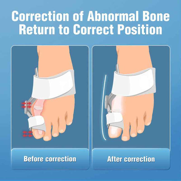 Aroflit™ High Quality Grade Bunion Toe Splint Straightener Corrector - Aroflit