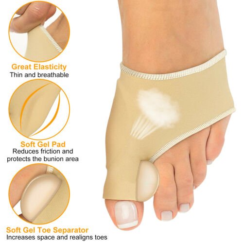 Corby™ - Non - Surgical Hallux Valgus Correction - Aroflit