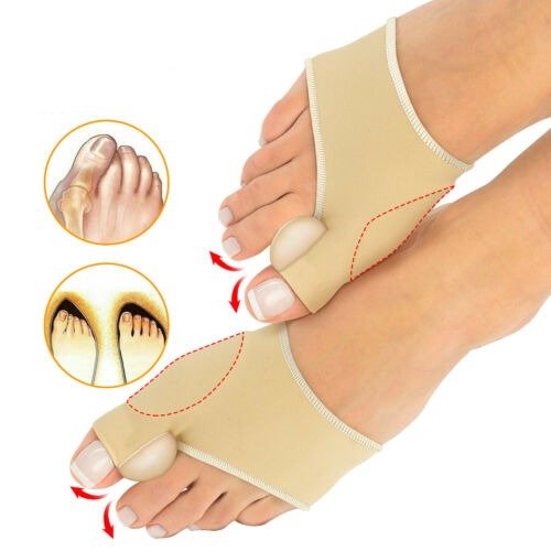 Corby™ - Non - Surgical Hallux Valgus Correction - Aroflit