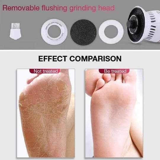 Electric Vacuum Adsorption Foot Grinder - Aroflit