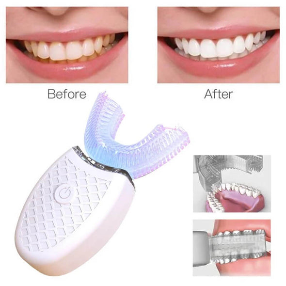 HEXOSONIC™ ULTRASONIC 360° TOOTHBRUSH - Aroflit