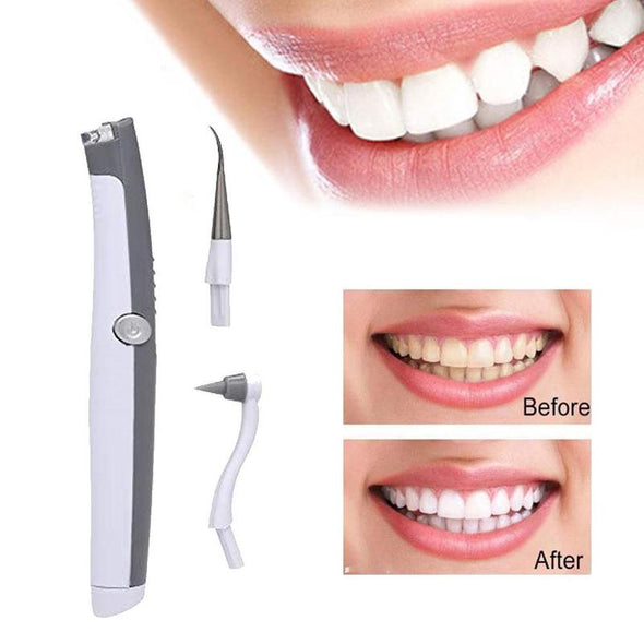 HEXOTEETH™ - ELECTRIC SONIC TOOTH STAIN & PLAQUE REMOVER-Aroflit
