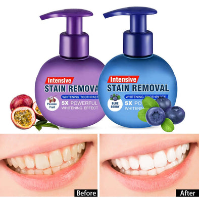 INTENSIVE™ NATURAL TEETH WHITENING TOOTHPASTE - Aroflit