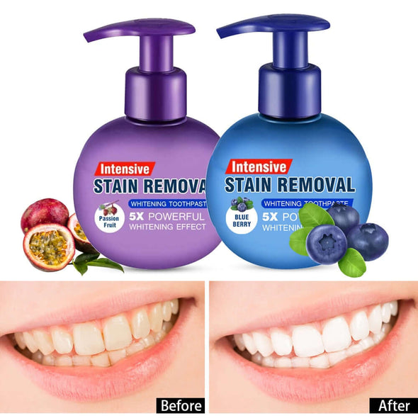 INTENSIVE™ NATURAL TEETH WHITENING TOOTHPASTE - Aroflit
