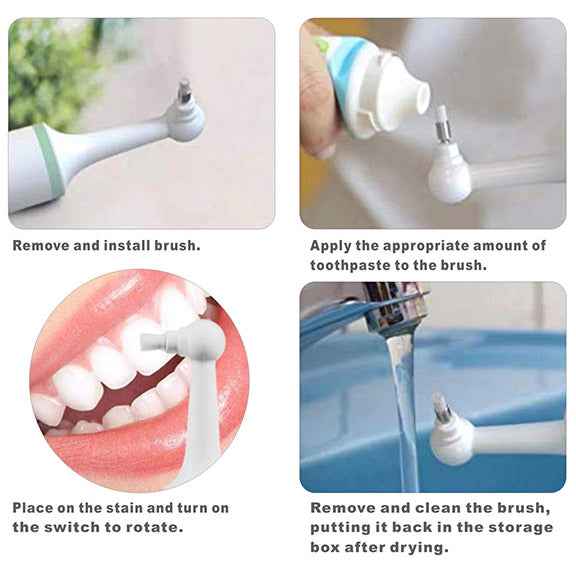 Powerful Plaque/Tartar Scaler & Calculus Teeth Stain Remover - Aroflit