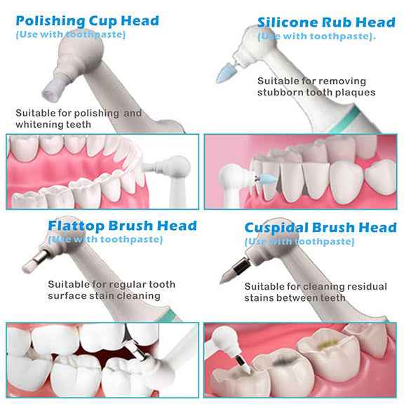 Powerful Plaque/Tartar Scaler & Calculus Teeth Stain Remover - Aroflit