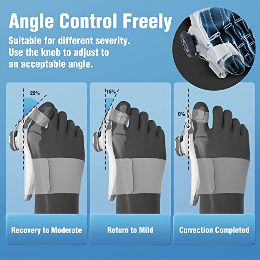 Premium Grade Orthopedic Toe Bunion Corrector - Aroflit