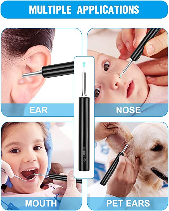 Smart Ear Wax Remover Otoscope - Aroflit