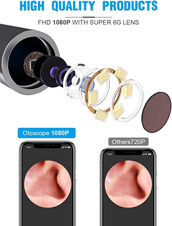 Smart Ear Wax Remover Otoscope - Aroflit