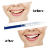 Teeth Whitening Oral Gel Polish Pen Kits with White Accelerator LED Light - Aroflit